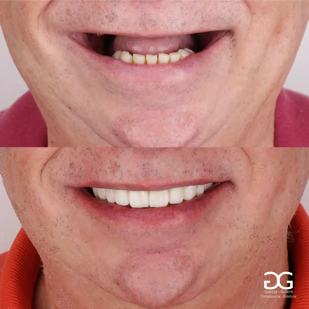 A&D Prótesis Dentales